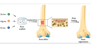 آرتروز