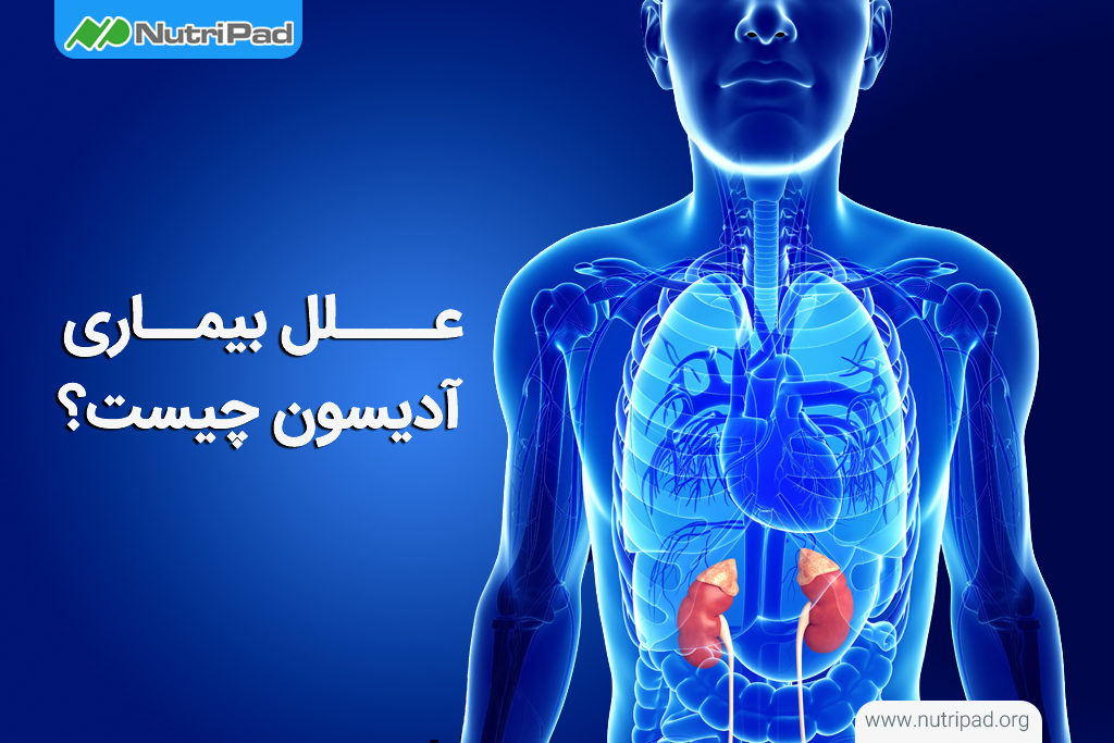 علت ایجاد بیماری آدیسون چیست؟