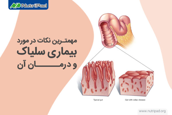 نکات مهم در مورد بیماری سلیاک و راه های درمان آن