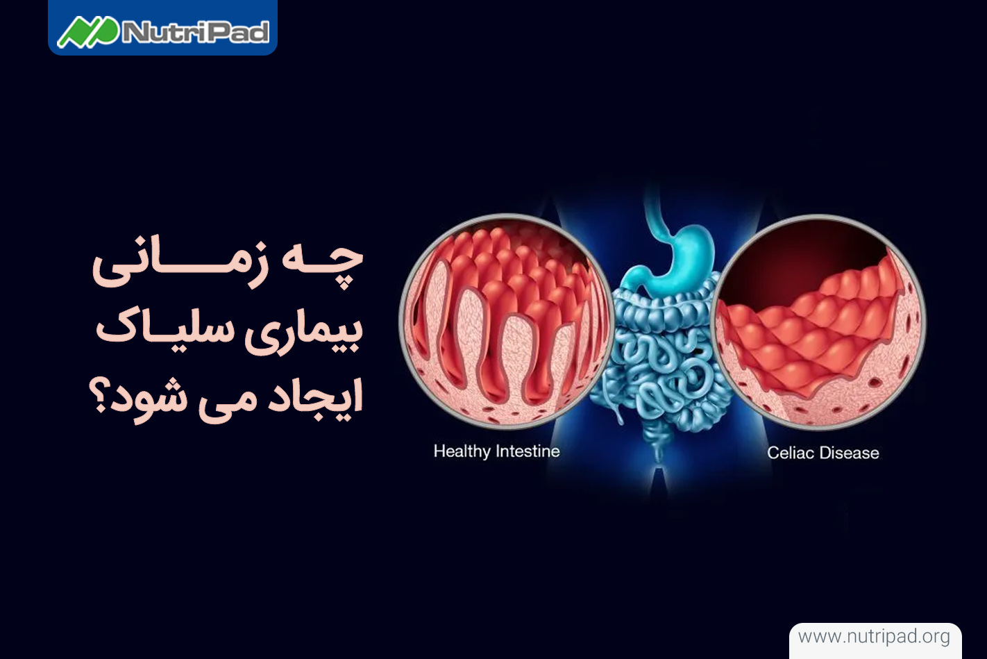 بیماری سلیاک چه زمانی ایجاد میشود؟