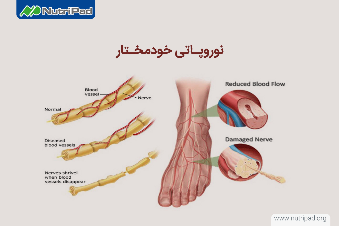 نوروپاتی خودمختار چیست؟