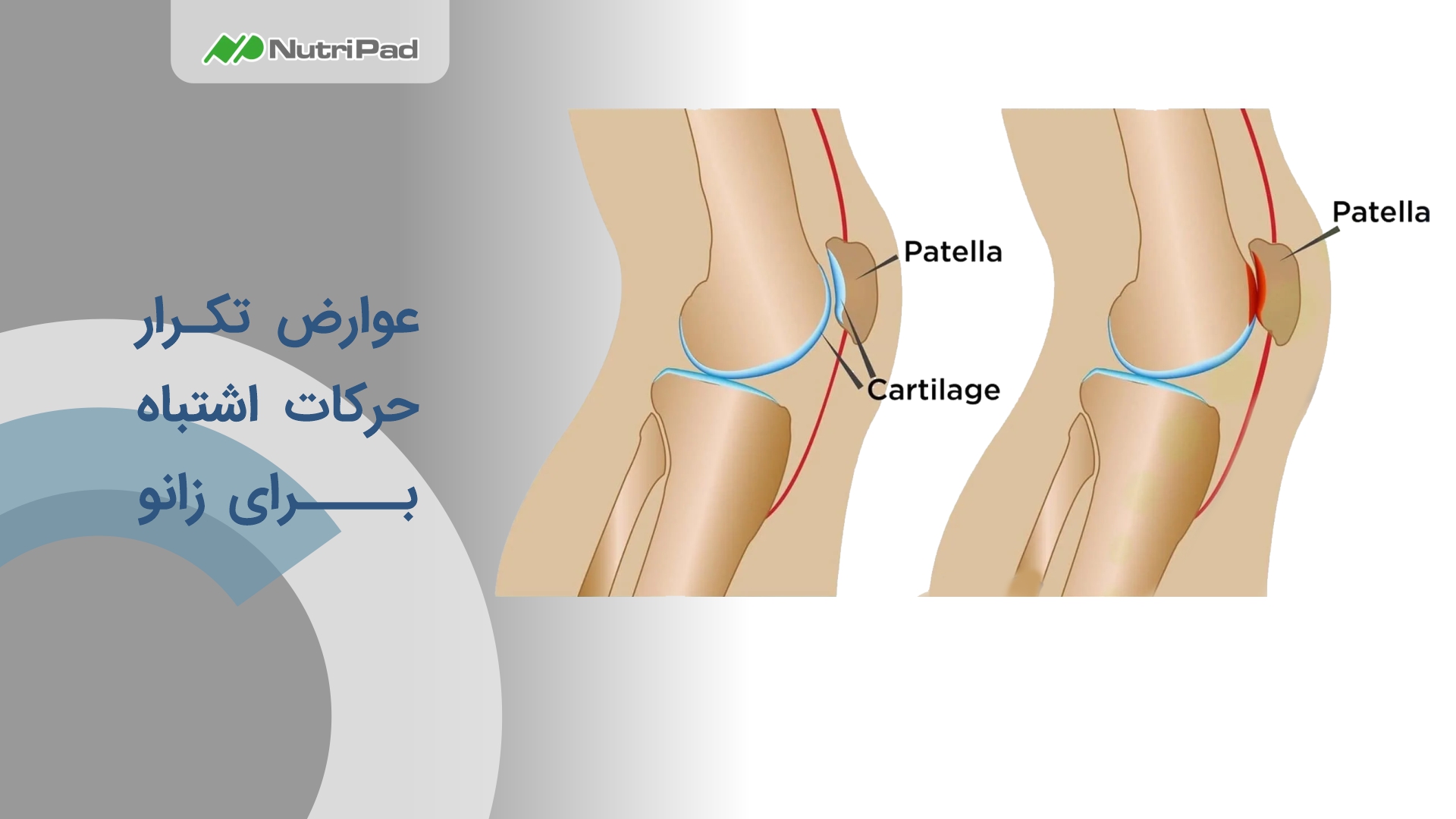 تکرار حرکات اشتباه برای زانو چه عوارضی دارد؟