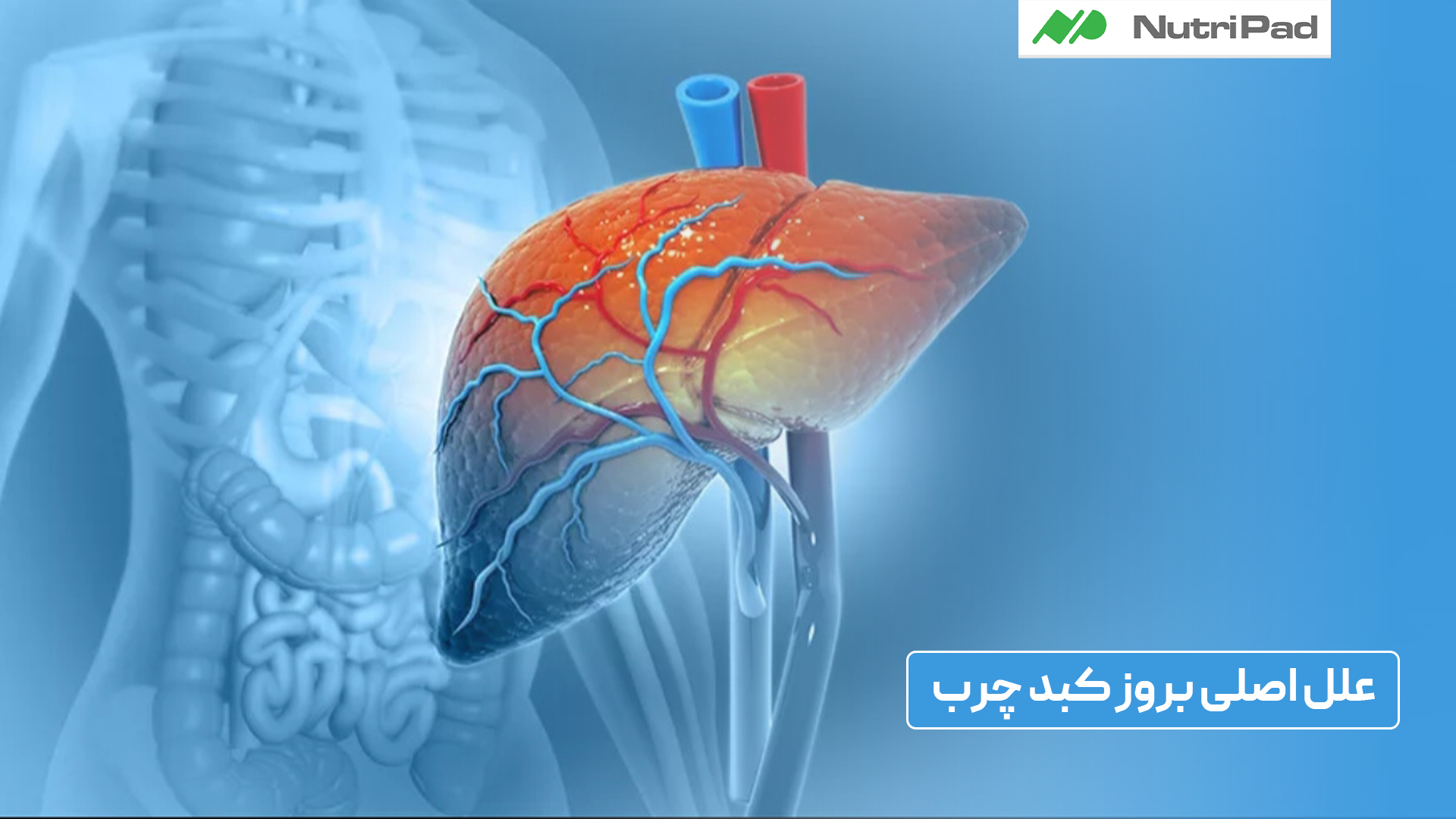 علل کبد چرب چیست؟ نوتری پاد