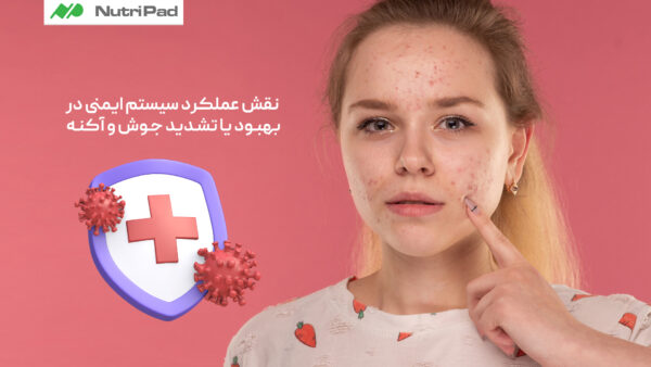 نقش سیستم ایمنی در کنترل آکنه و درمان جوش