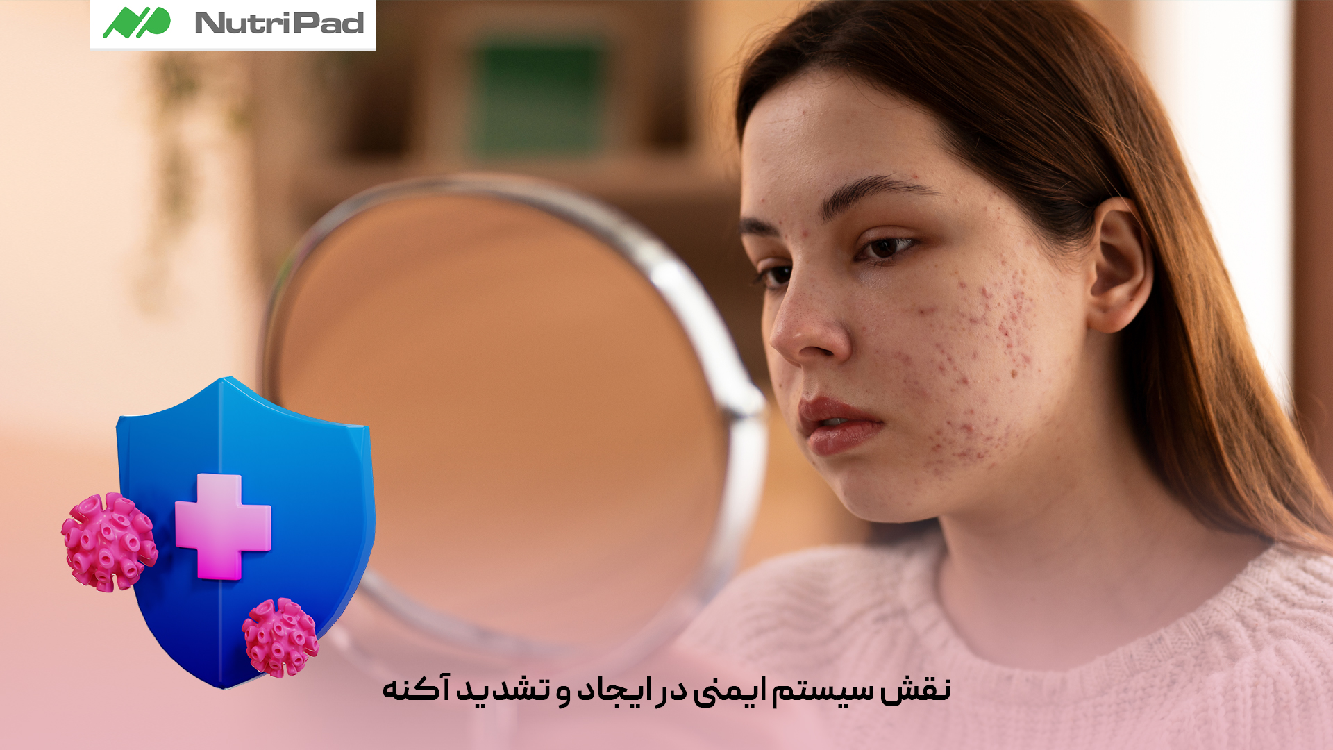 نقش سیستم ایمنی در ایجاد و تشدید آکنه چیست؟