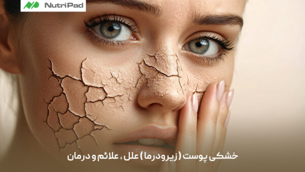 نوتری پاد