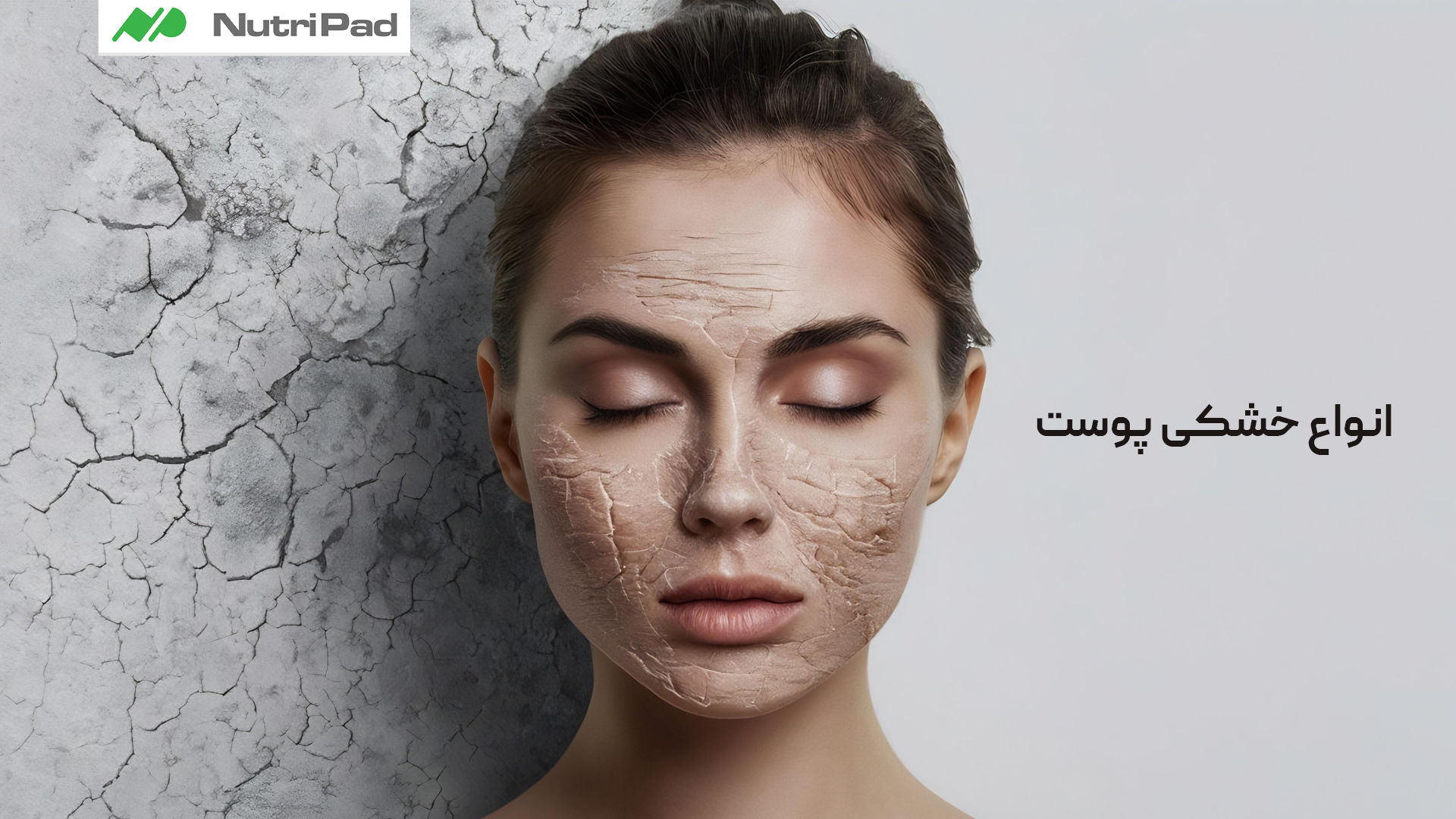 خشکی پوست چه علائمی دارد؟