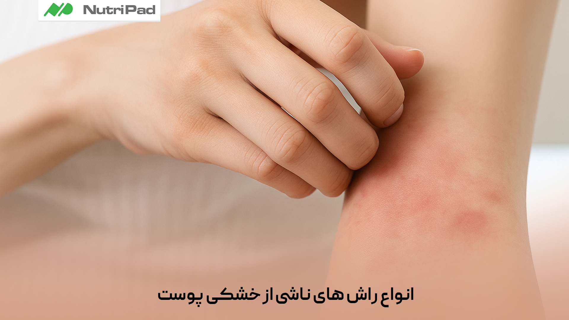 انواع راش‌های ناشی از خشکی پوست کدام‌اند و چگونه ظاهر می‌شوند؟