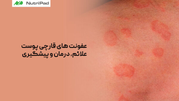 عفونت های قارچی پوست چه هستند و چه علائمی دارند؟