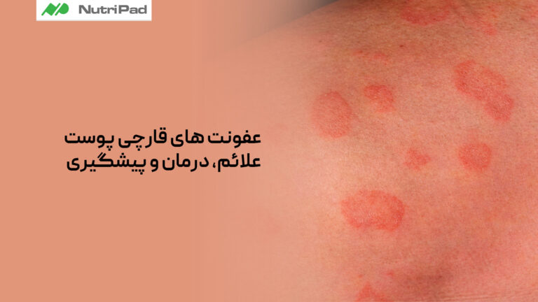 عفونت های قارچی پوست چه هستند و چه علائمی دارند؟