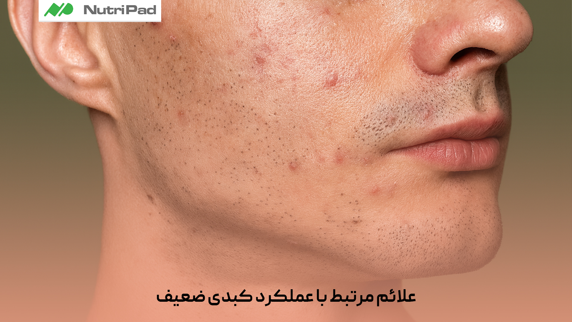 علائم مرتبط با عملکرد کبدی ضعیف چیست؟