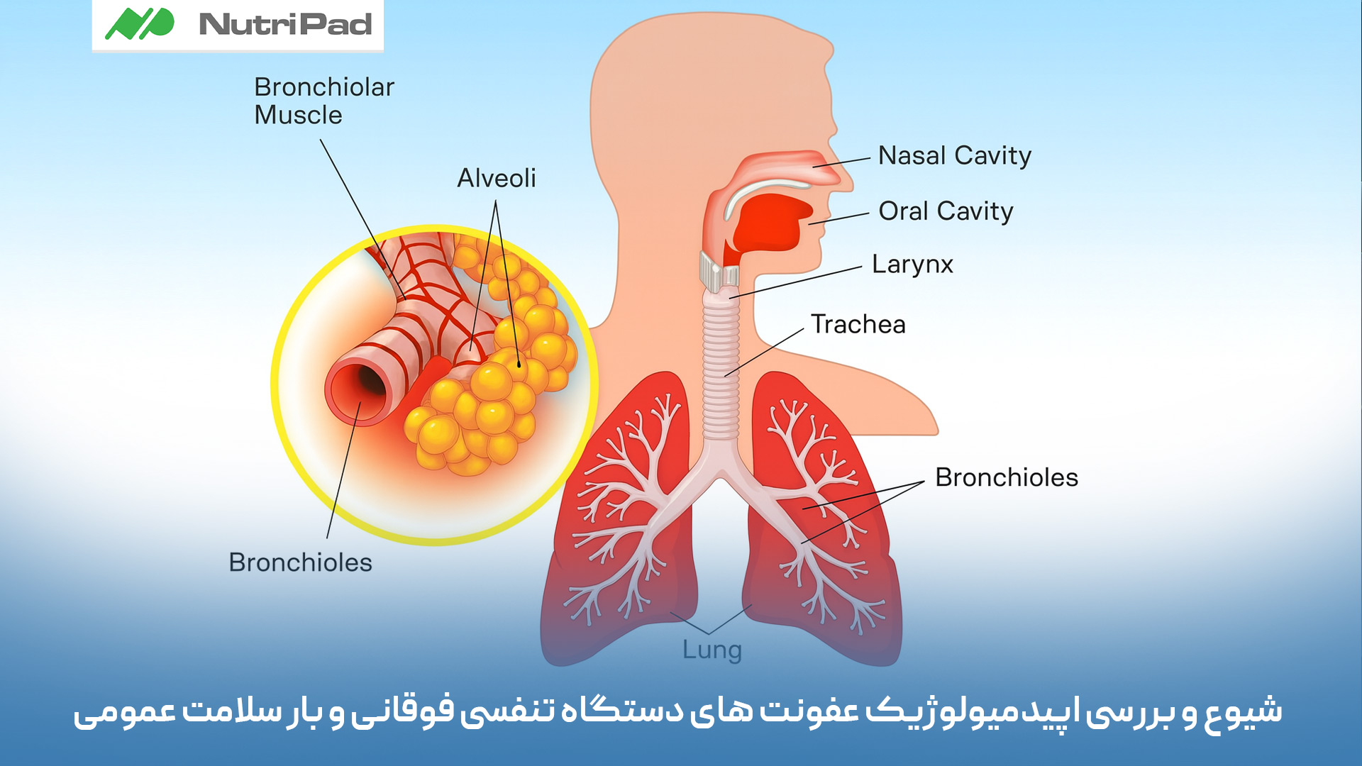 عفونت های دستگاه تنفسی فوقانی از شایع ترین بیماری ها در فصل سرما هستند و هر سال میلیونها نفر را مبتلا میکنند. این عفونتها در کودکان، سالمندان و افرادی با سیستم ایمنی ضعیف بیشتر دیده میشود. از نظر اپیدمیولوژیک، URIها بهدلیل انتقال آسان، افزایش غیبتهای کاری و مدرسه، نیاز به مراقبتهای پزشکی و مصرف دارو، بار قابل توجهی بر سیستم سلامت عمومی وارد میکنند. اگرچه بیشتر موارد خفیف و خودمحدودشونده هستند، اما شیوع بالا و سرعت انتقال آنها باعث میشود که مدیریت، پیشگیری و آموزش عمومی نقش مهمی در کاهش بار بیماری داشته باشد. شیوع عفونتهای دستگاه تنفسی فوقانی (URI) چقدر است و از نظر اپیدمیولوژیک چه تأثیری بر سلامت عمومی دارند؟