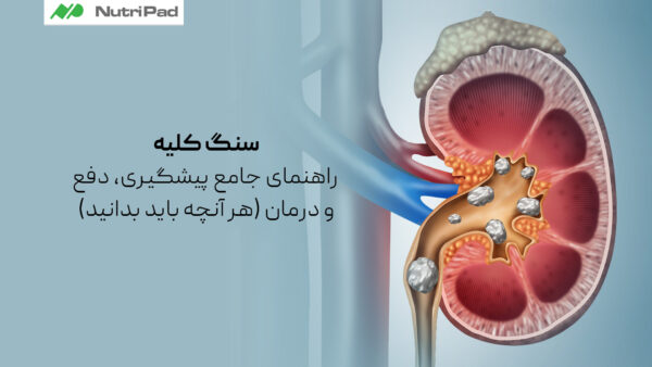 سنگ کلیه چیست و چرا تشکیل میشود؟
