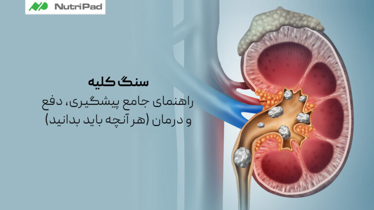 سنگ کلیه چیست و چرا تشکیل میشود؟