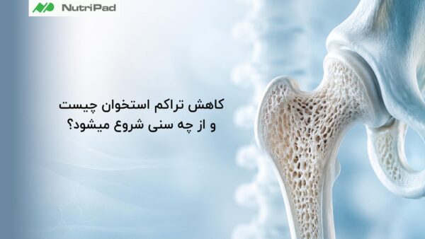 کاهش تراکم استخوان چیست و از چه سنی شروع میشود؟
