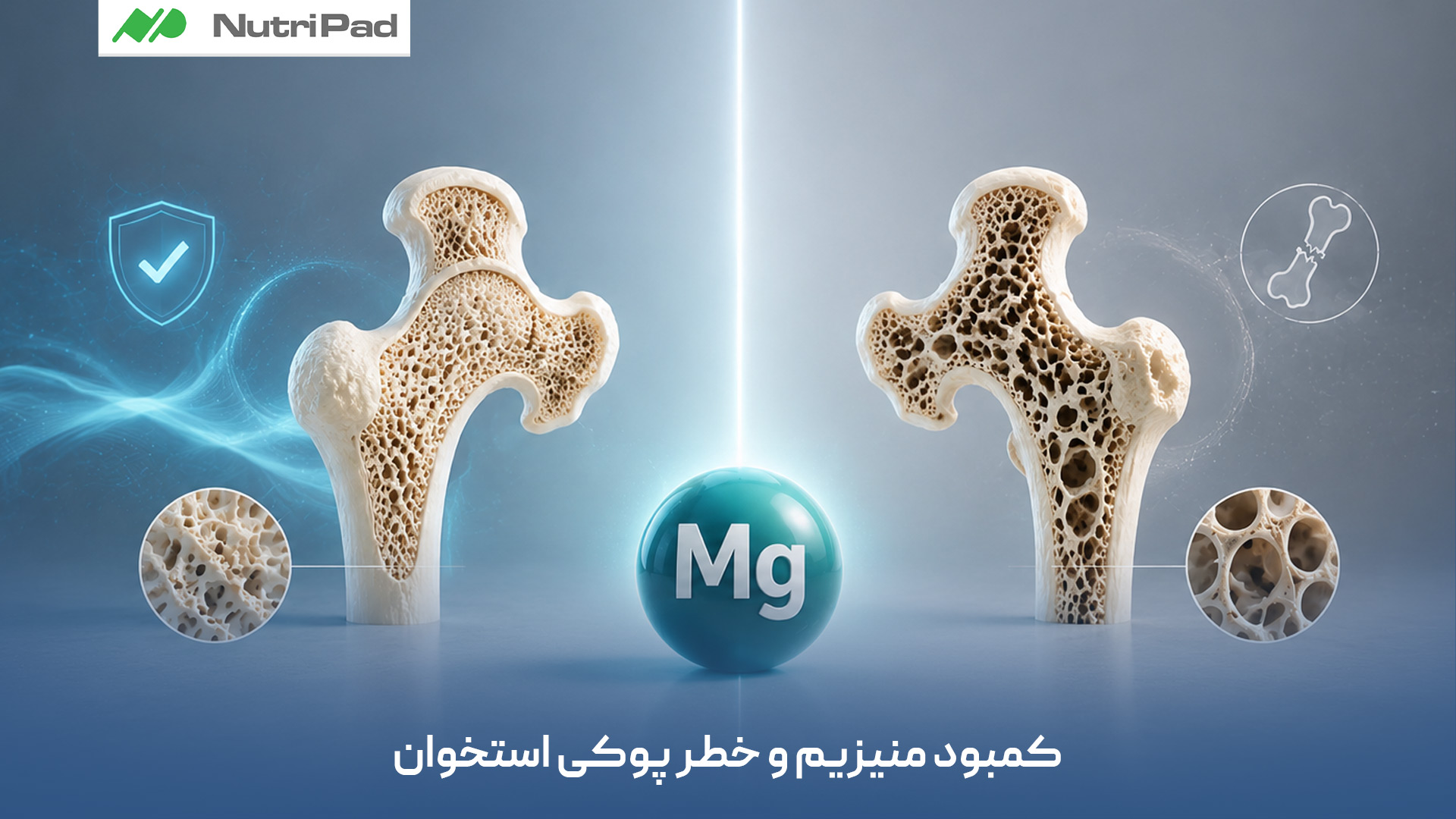 آشنایی با تأثیر کمبود منیزیم بر ضعف استخوان ها و افزایش احتمال پوکی استخوان در طولانی مدت. کمبود منیزیم و خطر پوکی استخوان