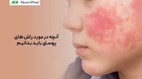 1 راشهای پوستی چیست و چه نکاتی باید درباره آنها بدانیم؟